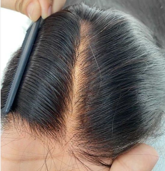 BYE-BYE KNOTS HD LACE 13X4 FULL FRONTAL WIG / SILK STRAIGHT